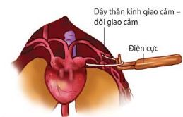 Dây thần kinh giao cảm - đối giao cảm